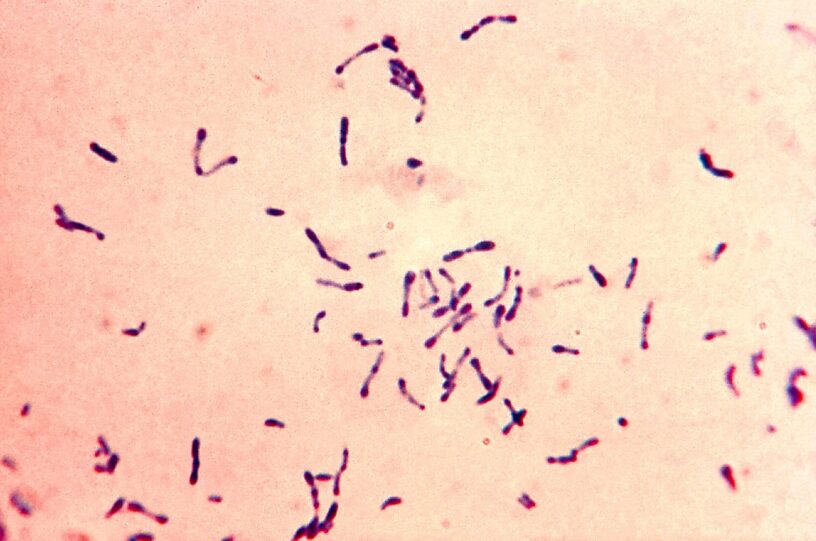 difterite-batteri-corynebacterium-diphtheriae-CDC